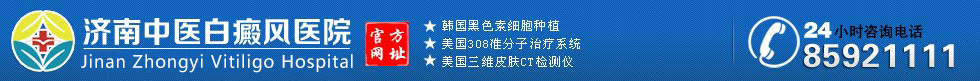 济南中医白癜风医院,济南白癜风医院